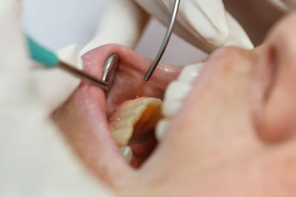 dental-laser-regina-lakeview-dental-centre