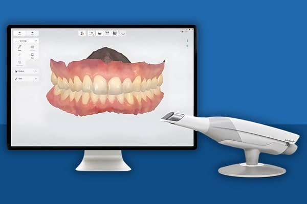 intraoral-camera-regina-lakeview-dentalcentre