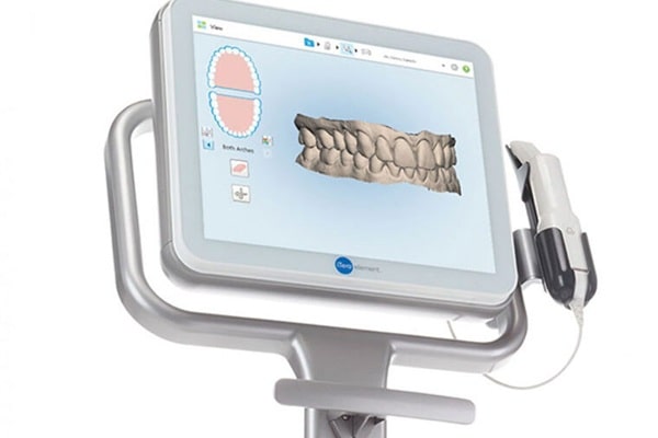 itero-scanner-regina-lakeview-dental-centre